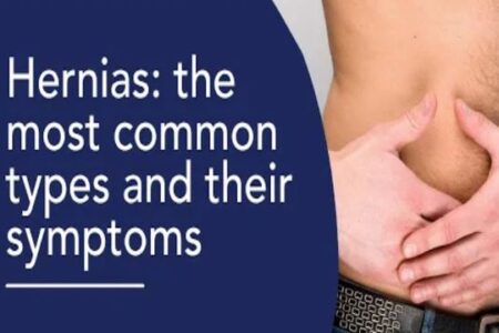 hernia3 Hernia, parastomal hernia,herniorrhaphy. Also hernia types and treatment.