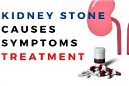 kidney2 Kidney stones signs,treatment and advice