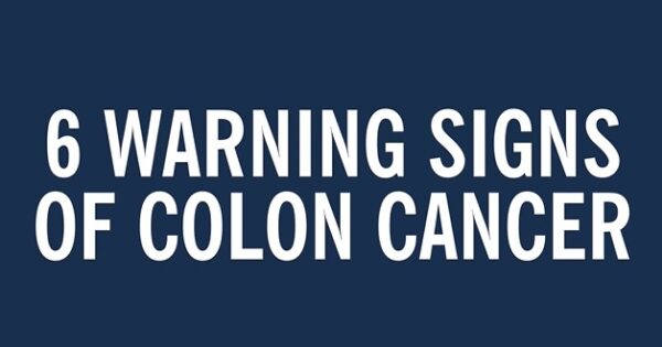 Colorectal Cancer: Causes, Symptoms and Treatment